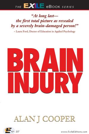 Cover of the book Brain Injury by Daniel David Moses