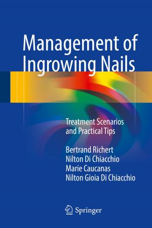 Cover of the book Management of Ingrowing Nails by Miguel A. Méndez
