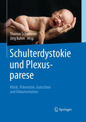 Cover of the book Schulterdystokie und Plexusparese by David D. O'Regan