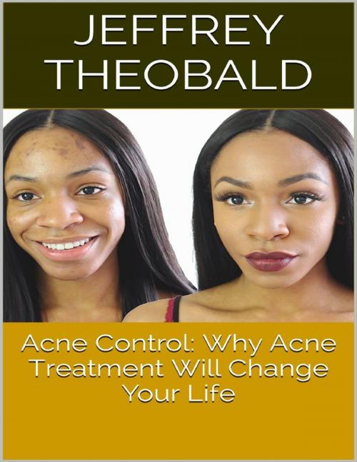 Cover of the book Acne Control: Why Acne Treatment Will Change Your Life by Jeffrey Theobald, Lulu.com