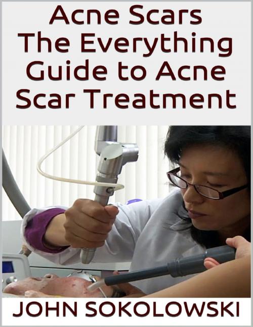 Cover of the book Acne Scars: The Everything Guide to Acne Scar Treatment by John Sokolowski, Lulu.com