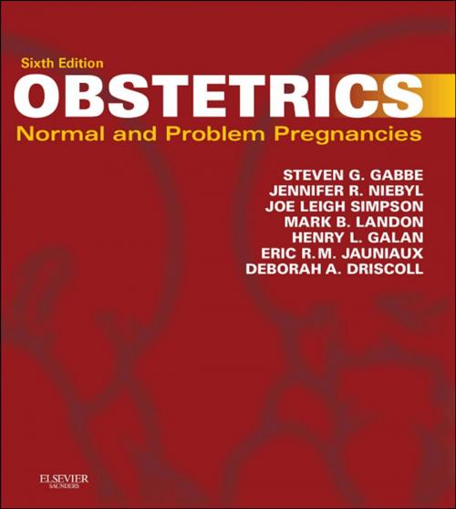 Cover of the book Obstetrics: Normal and Problem Pregnancies E-Book by Steven G. Gabbe, MD, Jennifer R. Niebyl, MD, Henry L Galan, MD, Eric R. M. Jauniaux, MD, PhD, FRCOG, Mark B Landon, MD, Joe Leigh Simpson, MD, Deborah A Driscoll, MD, Elsevier Health Sciences