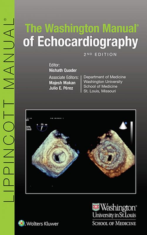 Cover of the book Washington University Manual of Echocardiography by Nishath Quader, Majesh Makan, Julio Perez, Wolters Kluwer Health