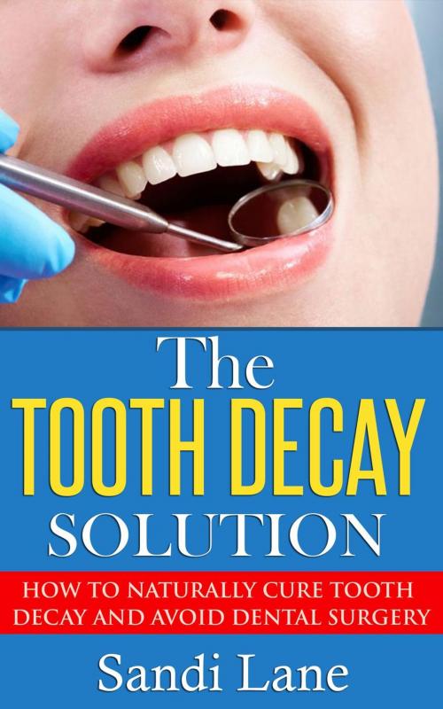 Cover of the book The Tooth Decay Solution by Sandi Lane, Sandi Lane