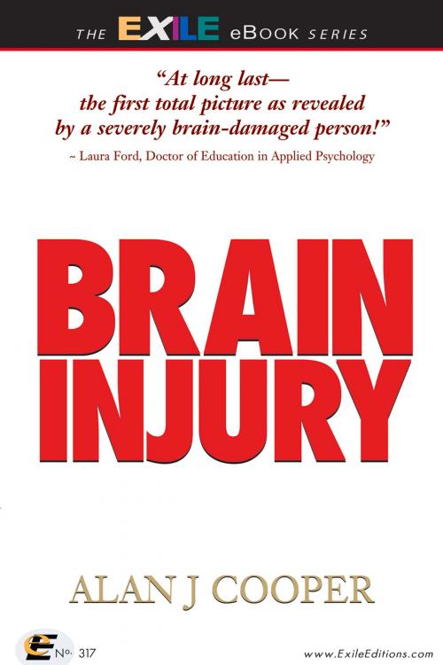 Cover of the book Brain Injury by Alan Cooper, Exile Editions