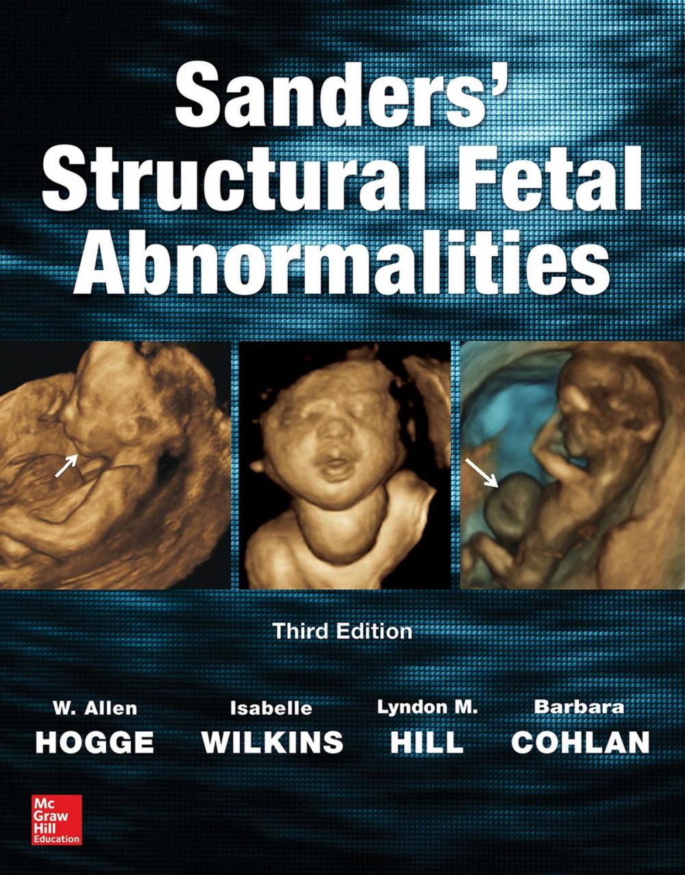 Big bigCover of Sanders' Structural Fetal Abnormalities, Third Edition