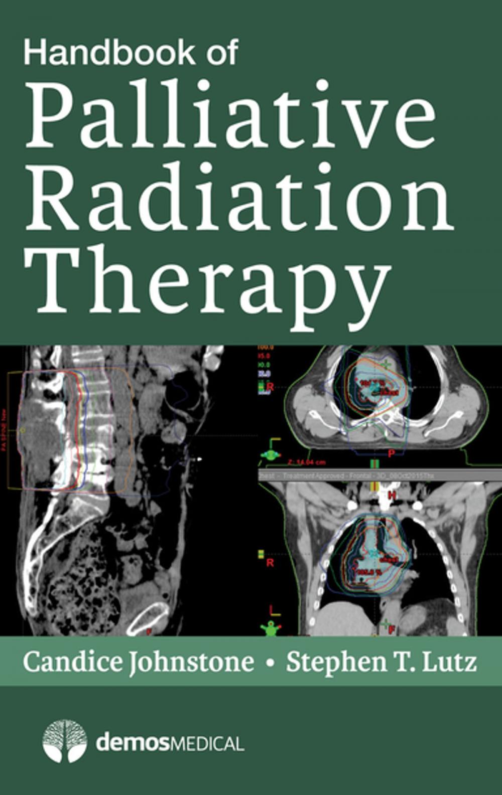 Big bigCover of Handbook of Palliative Radiation Therapy