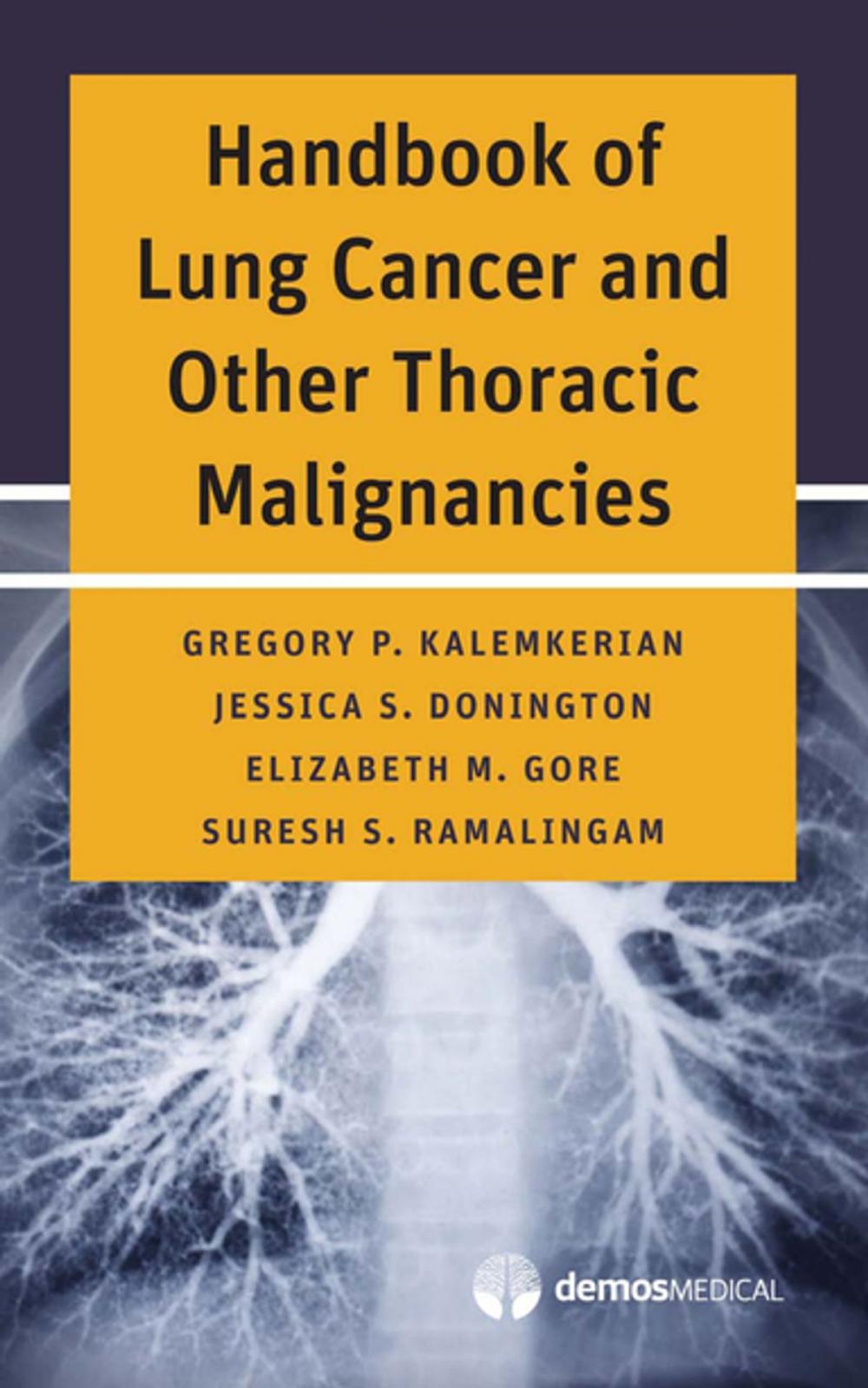 Big bigCover of Handbook of Lung Cancer and Other Thoracic Malignancies