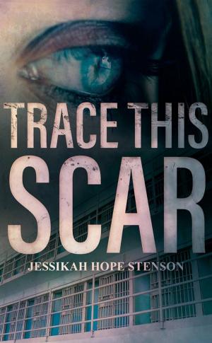 Cover of the book Trace This Scar by Jimmy Smyth