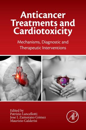 Cover of the book Anticancer Treatments and Cardiotoxicity by Allen I. Laskin, Geoffrey M. Gadd, Sima Sariaslani