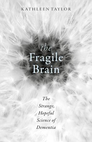 Cover of the book The Fragile Brain by William Blackstone