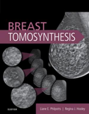 Cover of the book Breast Tomosynthesis E-Book by Vishram Singh