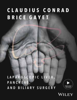 bigCover of the book Laparoscopic Liver, Pancreas, and Biliary Surgery, Textbook and Illustrated Video Atlas by 