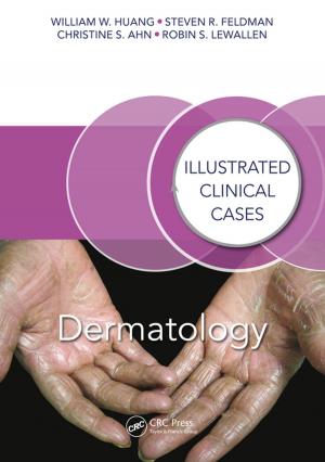 Cover of the book Dermatology by Nihal Kularatna