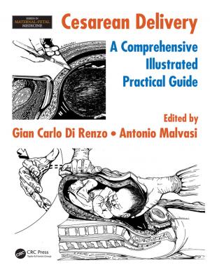 Cover of the book Cesarean Delivery by Fabio Ganovelli, Massimiliano Corsini, Sumanta Pattanaik, Marco Di Benedetto