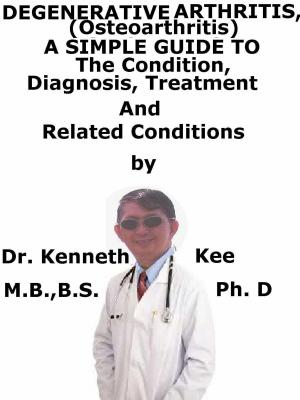 Cover of Degenerative Arthritis (Osteoarthritis) A Simple Guide To The Condition, Diagnosis, Treatment And Related Conditions