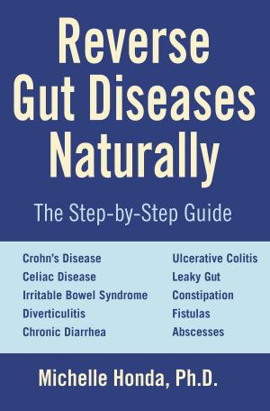 Cover of the book Reverse Gut Diseases Naturally by Meniere Man
