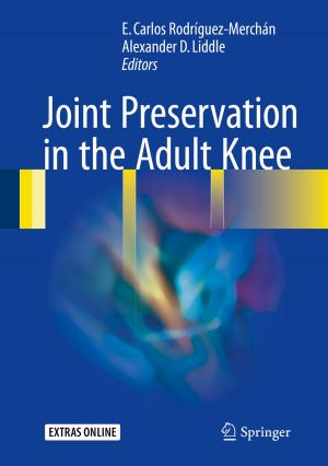 Cover of Joint Preservation in the Adult Knee