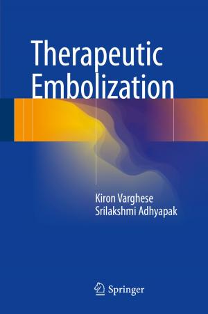 Cover of the book Therapeutic Embolization by Iwona Skalna, Bogdan Rębiasz, Bartłomiej Gaweł, Beata Basiura, Jerzy Duda, Janusz Opiła, Tomasz Pełech-Pilichowski