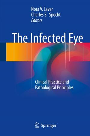 Cover of the book The Infected Eye by Anil K. Suresh