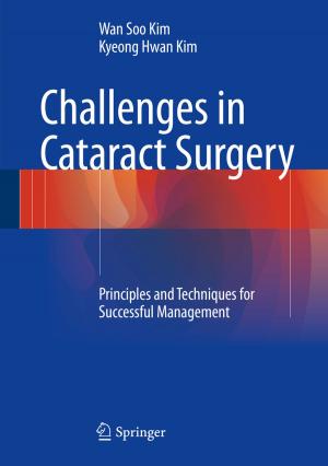 Cover of the book Challenges in Cataract Surgery by Ulrich Wiek