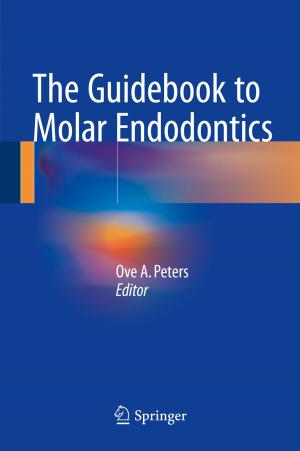 Cover of the book The Guidebook to Molar Endodontics by Kai-Uwe Schmitt, Peter F. Niederer, Duane S. Cronin, Markus H. Muser, Felix Walz