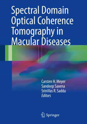 Cover of the book Spectral Domain Optical Coherence Tomography in Macular Diseases by Altafhusain Nadaf, Rahul Zanan
