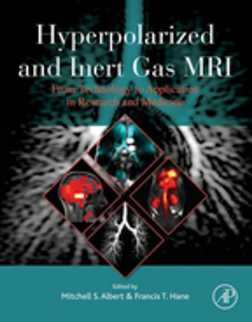 Cover of the book Hyperpolarized and Inert Gas MRI by , Elsevier Science