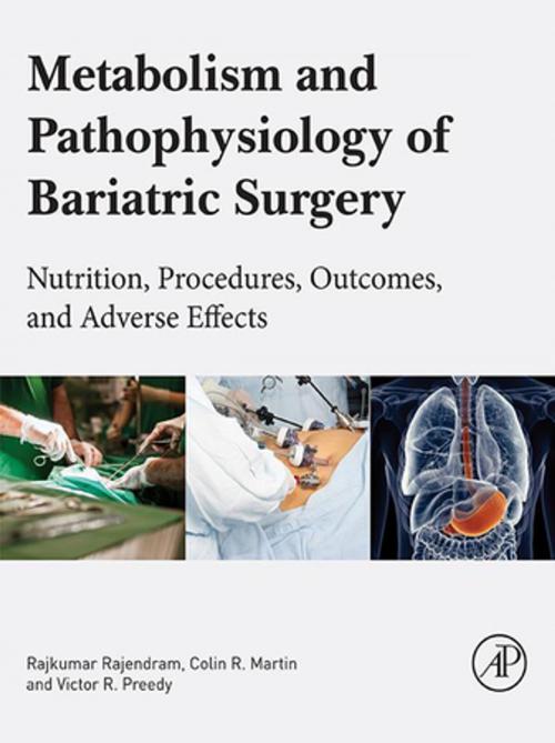 Cover of the book Metabolism and Pathophysiology of Bariatric Surgery by , Elsevier Science