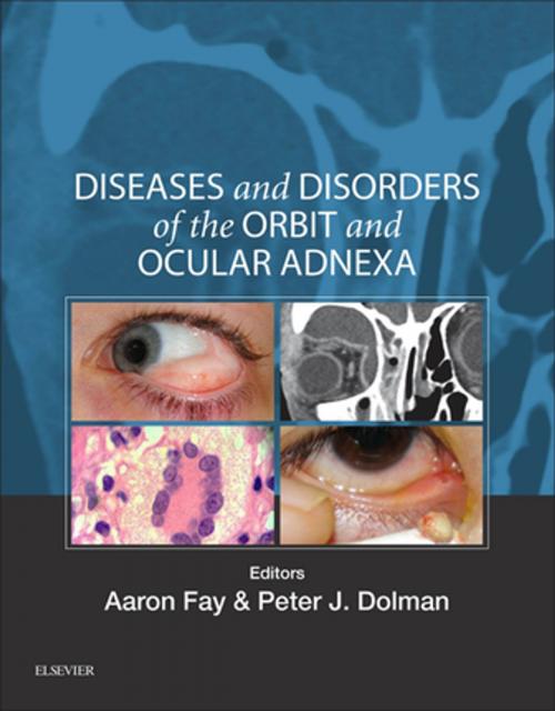 Cover of the book Diseases and Disorders of the Orbit and Ocular Adnexa E-Book by Aaron Fay, MD, Peter J Dolman, MD, FRCSC, Elsevier Health Sciences