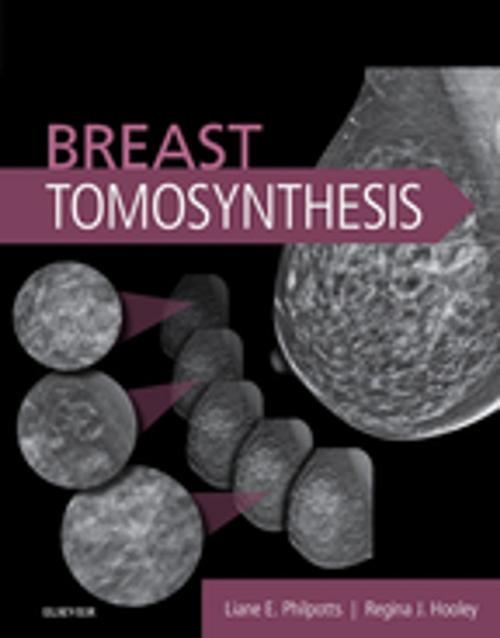 Cover of the book Breast Tomosynthesis E-Book by Liane E Philpotts, MD, FACR, Regina J Hooley, MD, Elsevier Health Sciences