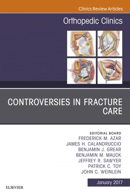 Cover of the book Controversies in Fracture Care, An Issue of Orthopedic Clinics, E-Book by Frederick M Azar, MD, James H. Calandruccio, MD, Benjamin J. Grear, MD, Benjamin M. Mauck, MD, Jeffrey R. Sawyer, MD, Patrick C. Toy, MD, John C. Weinlein, MD, Elsevier Health Sciences
