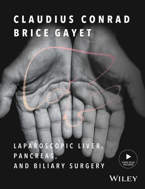 Cover of the book Laparoscopic Liver, Pancreas, and Biliary Surgery, Textbook and Illustrated Video Atlas by , Wiley