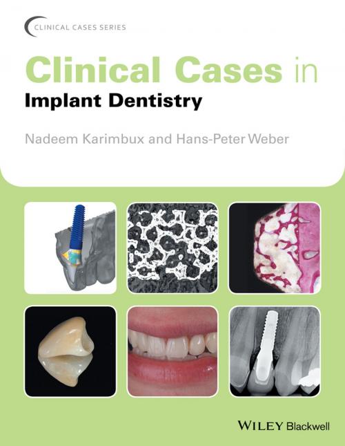 Cover of the book Clinical Cases in Implant Dentistry by , Wiley