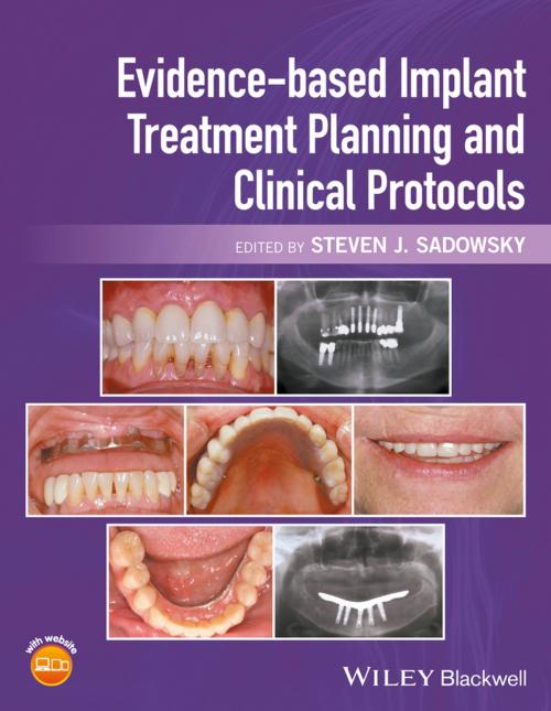 Cover of the book Evidence-based Implant Treatment Planning and Clinical Protocols by , Wiley