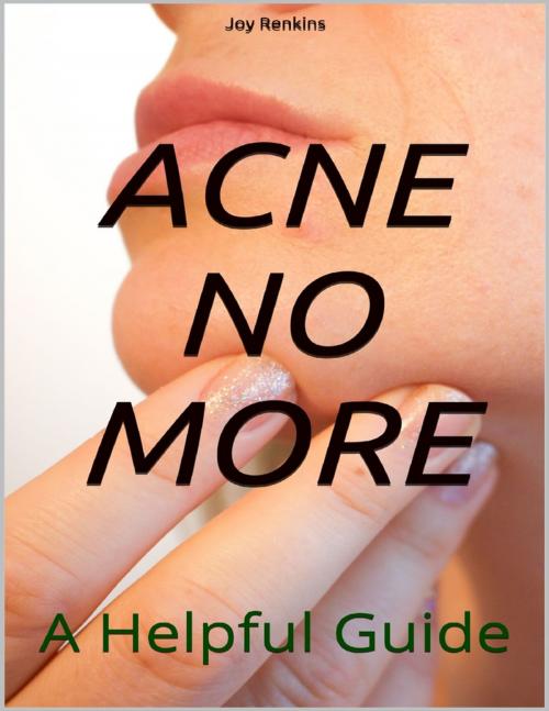 Cover of the book Acne No More;A Helpful Guide by Joy Renkins, Lulu.com