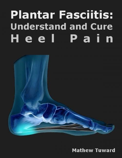 Cover of the book Plantar Fasciitis: Understand and Cure Heel Pain by Mathew Tuward, Lulu.com
