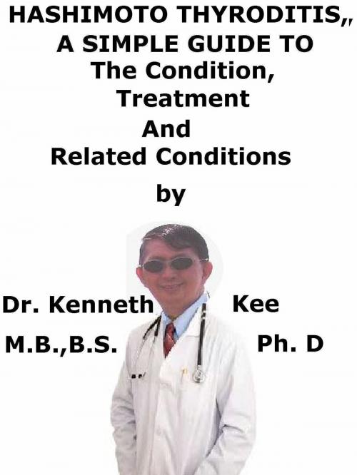 Cover of the book Hashimoto Thyroiditis, A Simple Guide To The Condition, Treatment And Related Conditions by Kenneth Kee, Kenneth Kee