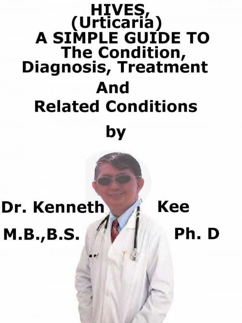 Cover of the book Hives, (Urticaria) A Simple Guide To The Condition, Diagnosis, Treatment And Related Conditions by Kenneth Kee, Kenneth Kee