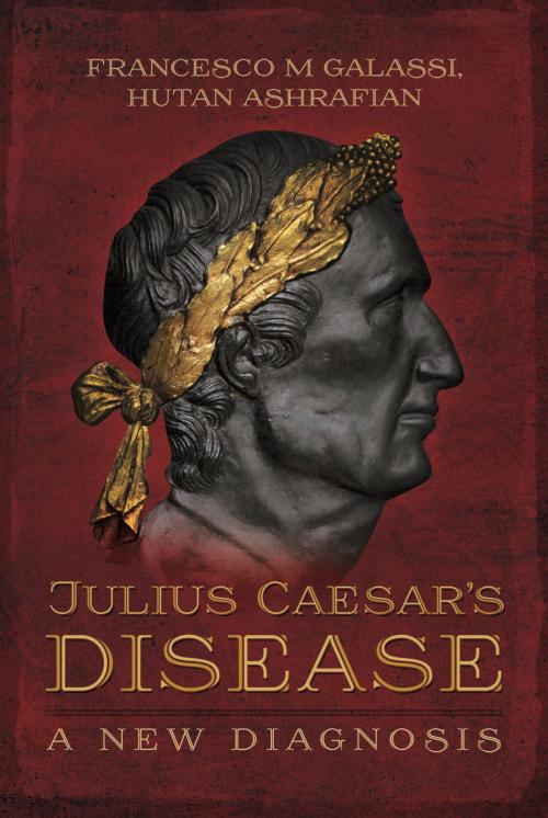 Cover of the book Julius Caesar's Disease by Francesco Maria Galassi, Hutan Ashrafian, Pen and Sword