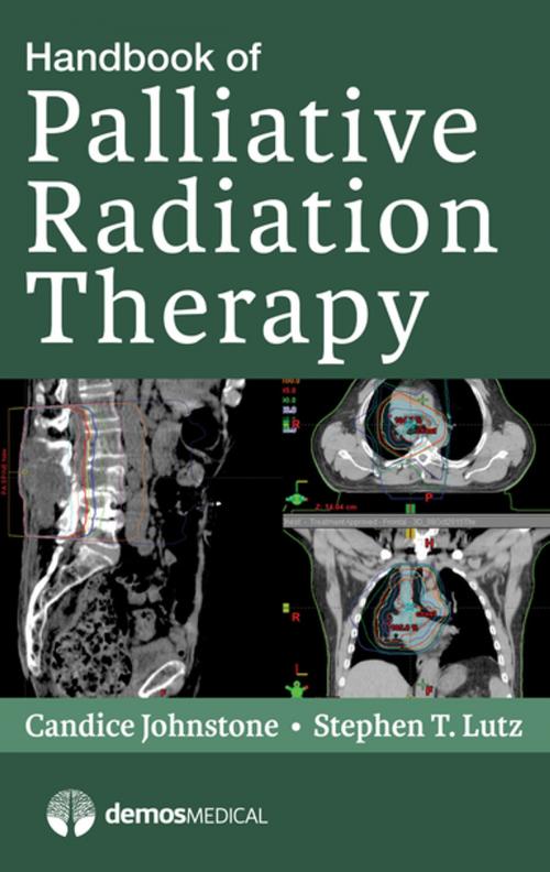 Cover of the book Handbook of Palliative Radiation Therapy by Candice Johnstone, MD, MPH, Stephen Lutz, MD, MS, Springer Publishing Company