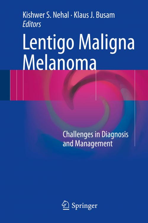Cover of the book Lentigo Maligna Melanoma by , Springer International Publishing
