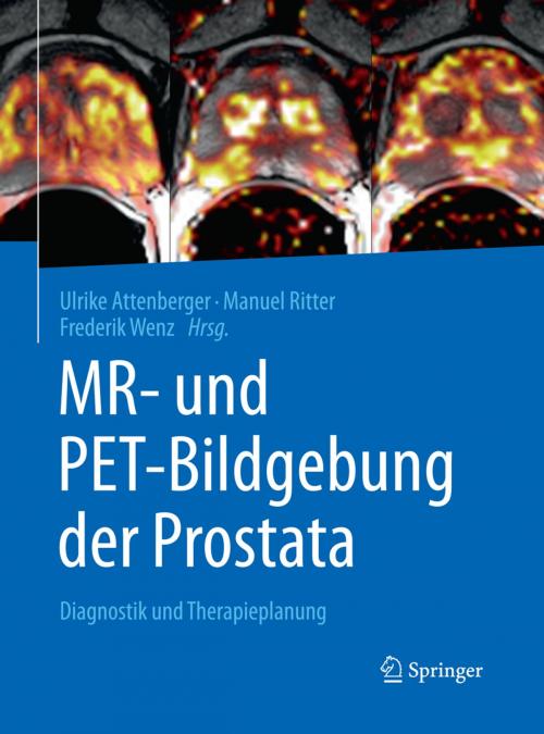 Cover of the book MR- und PET-Bildgebung der Prostata by , Springer Berlin Heidelberg