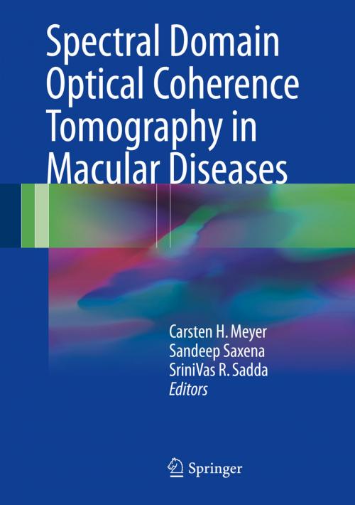 Cover of the book Spectral Domain Optical Coherence Tomography in Macular Diseases by , Springer India