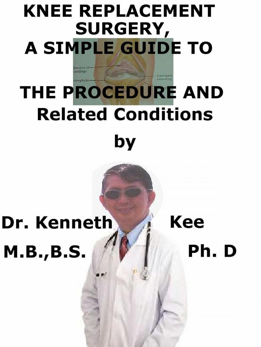Big bigCover of Knee Replacement Surgery, A Simple Guide To The Procedure And Related Conditions