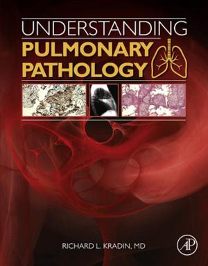 Cover of the book Understanding Pulmonary Pathology by Andrew Thompson, Peter Deplazes, Alan J. Lymbery