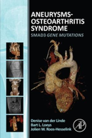 Cover of the book Aneurysms-Osteoarthritis Syndrome by Elena Ibanez, Alejandro Cifuentes