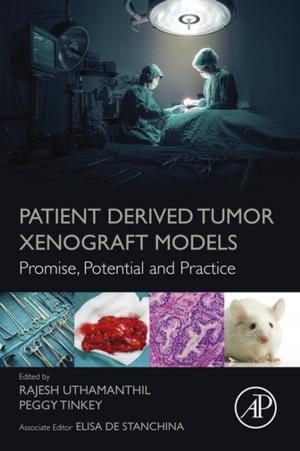 Cover of the book Patient Derived Tumor Xenograft Models by Dhiya Al-Jumeily, Abir Hussain, Conor Mallucci, Carol Oliver