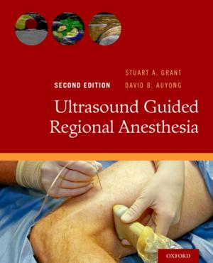 Cover of the book Ultrasound Guided Regional Anesthesia by Brian North, Mila Angelova, Elżbieta Jarosz, Richard Rossner