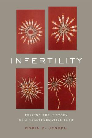 Cover of the book Infertility by Kathleen Pickering, Mark H. Harvey, Gene F. Summers, David Mushinski